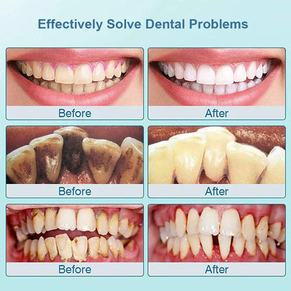 Electric Sonic Toothbrush